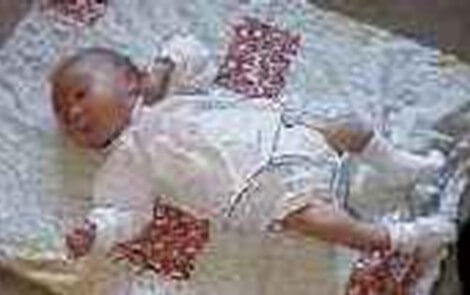 Görme veya İlave Engelli Çocukların Gelişimi Motor Gelişimi