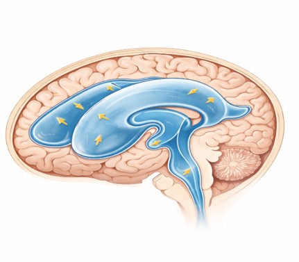 Hidrosefali-ve-Serebral-Görme-Bozukluğu