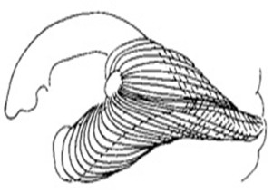 Optik-radyasyonların-lateral-ventriküllerin-çevresinden-dolanması
