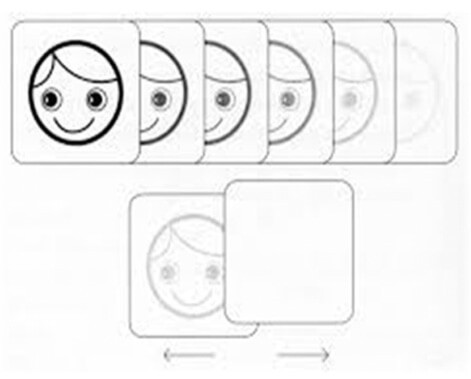 SGB-Çocukta-Rutin-Göz-Muayenesi-4