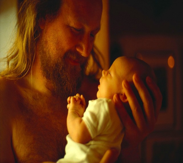 Serebral Görme Bozukluğu Ve Periventriküler Lökomalazi.